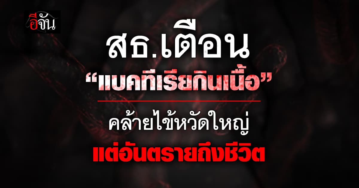 สธ.เตือน! “แบคทีเรียกินเนื้อ” อาการคล้ายไข้หวัดใหญ่ แต่อันตรายถึงชีวิต