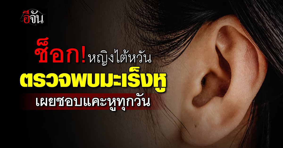สาวไต้หวันช็อกหนัก ชอบแคะหูทุกวันจนหูอักเสบ ก่อนตรวจพบเชื้อมะเร็ง