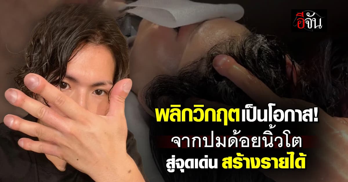 พลิกวิกฤตเป็นโอกาส! จากหนุ่มมีปม “นิ้วโตผิดปกติ” สู่จุดเด่น สร้างรายได้