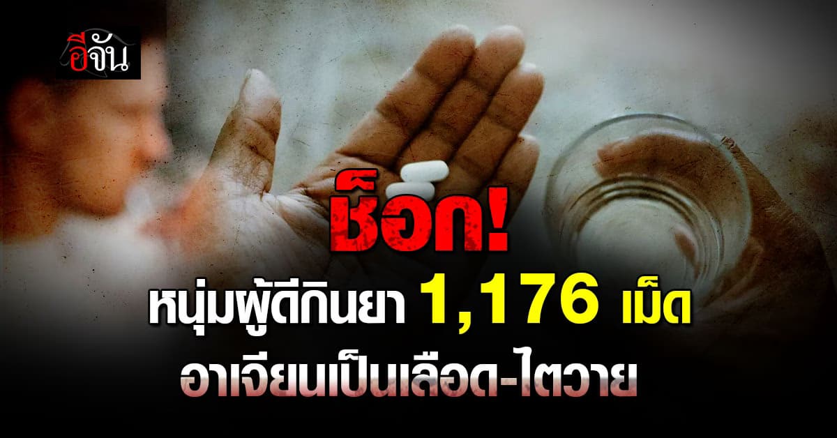 ช็อกหนัก หนุ่มกินยา 1,176 เม็ด หวังแก้ปวด ก่อนอาเจียนเป็นเลือด-ไตวาย   