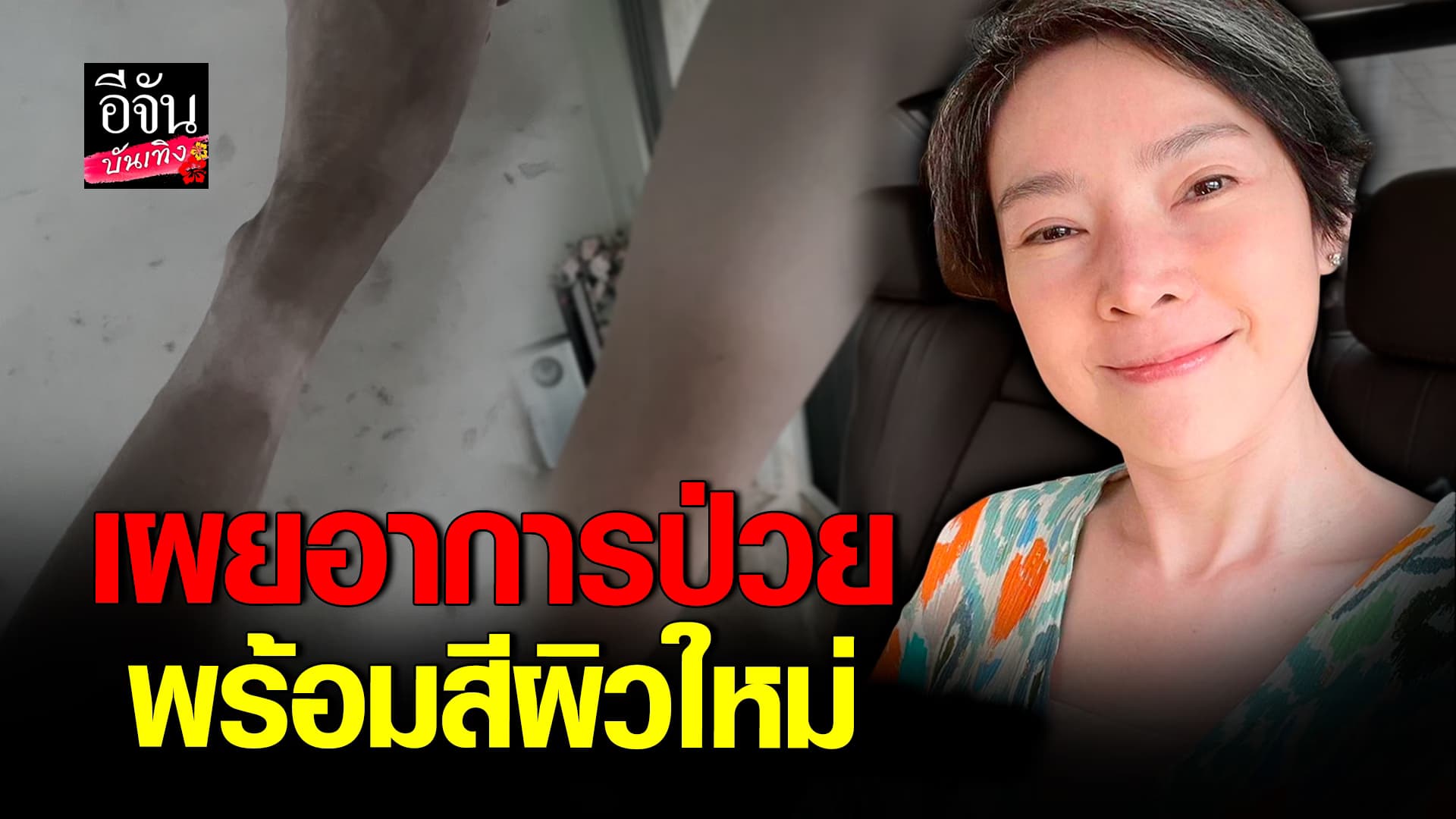 🎬คลิปบันเทิง : นิ้ง กุลสตรี อัพเดทอาการป่วย แม้เจออุปสรรค แต่ใจสู้สุดๆ