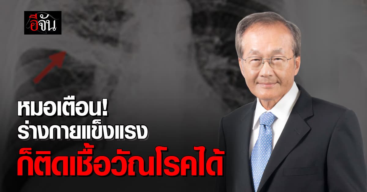 หมอเตือน! ร่างกายแข็งแรง ก็ติดเชื้อวัณโรคได้