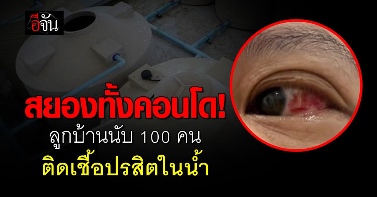 สยองทั้งคอนโด! ลูกบ้านร้องติดเชื้อตาแดงนับ 100 คน ตรวจพบ “ปรสิตในน้ำ”