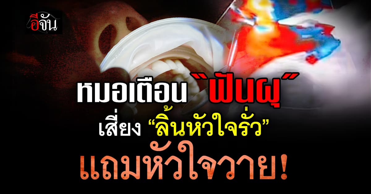 หมอเตือน “ฟันผุ” อาจนำไปสู่โรคลิ้นหัวใจรั่ว ถึงขั้นหัวใจวาย