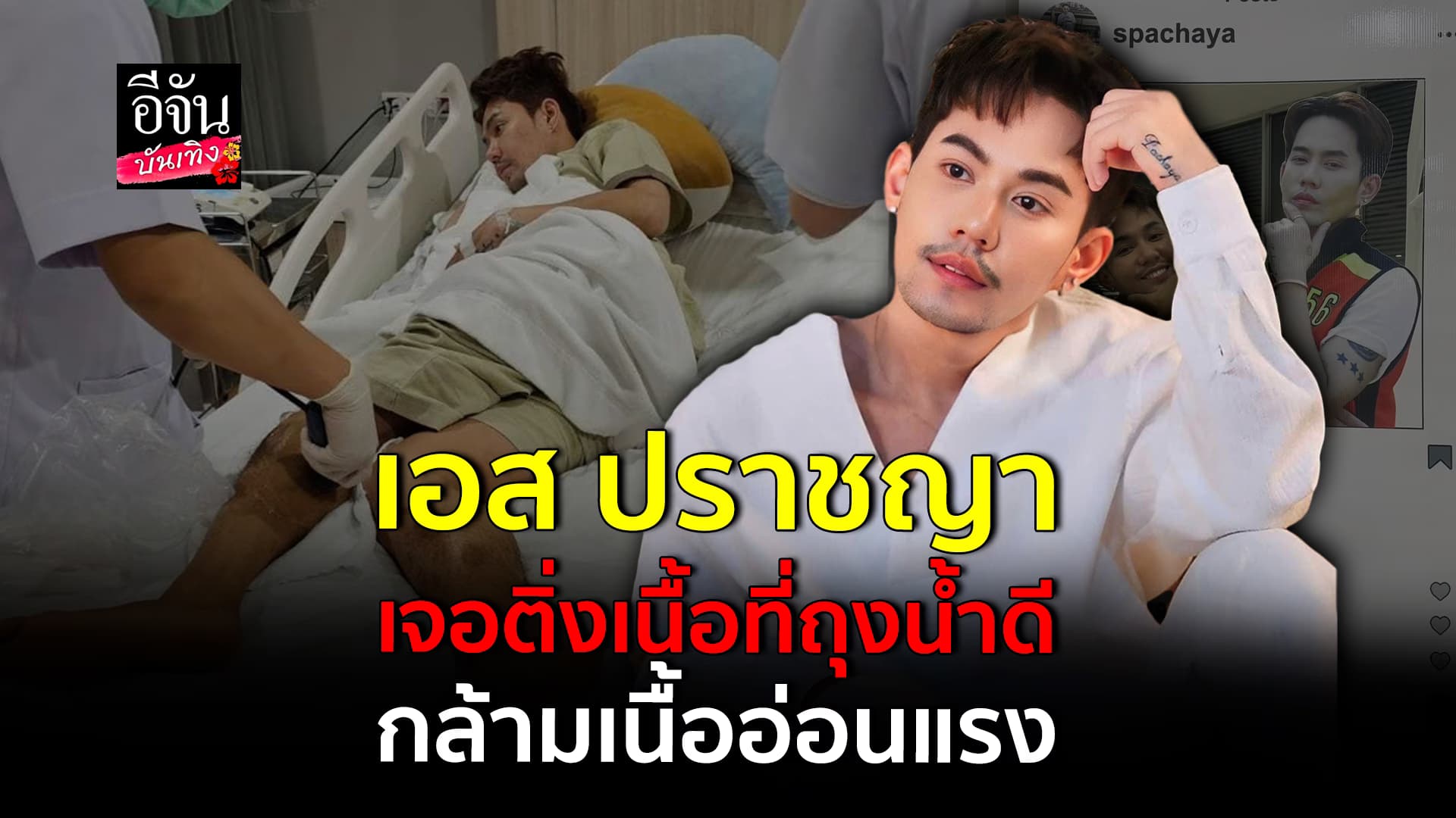 🎬คลิปบันเทิง : แห่ห่วง เอส ปราชญา ป่วยหนัก ต้องแอดมิทเข้าโรงพยาบาล พร้อมอัปเดตอาการล่าสุด