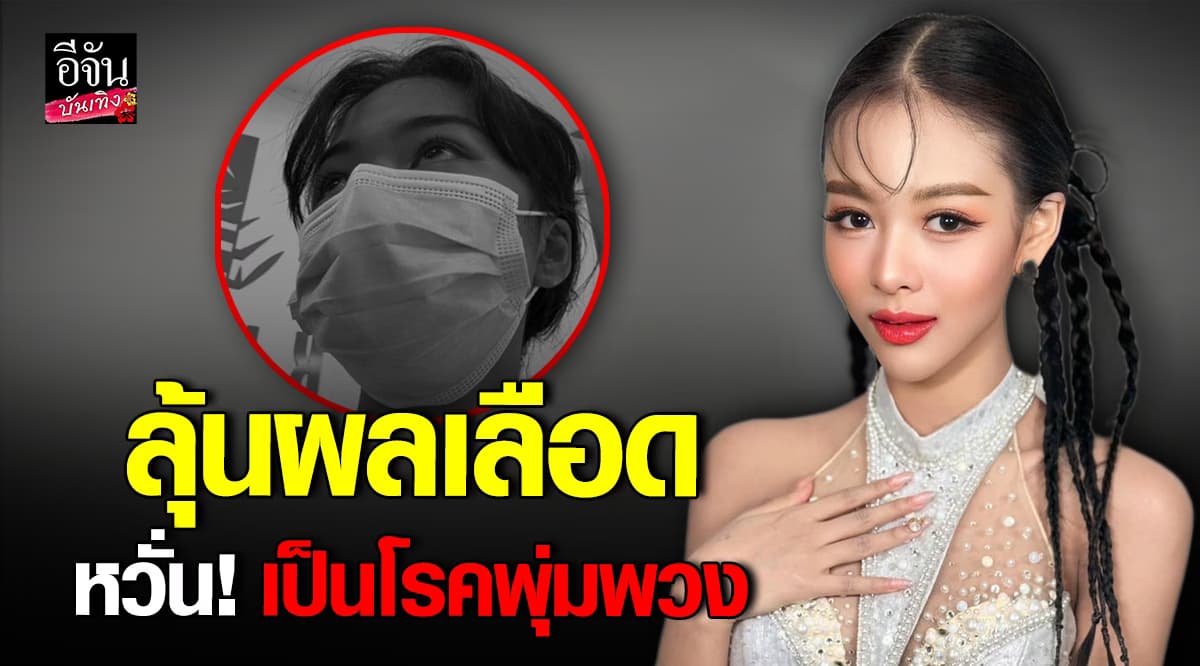 ลุ้น! ยูกิไหทองคำ ลุ้นผลเลือด หวั่นเป็น โรคพุ่มพวง