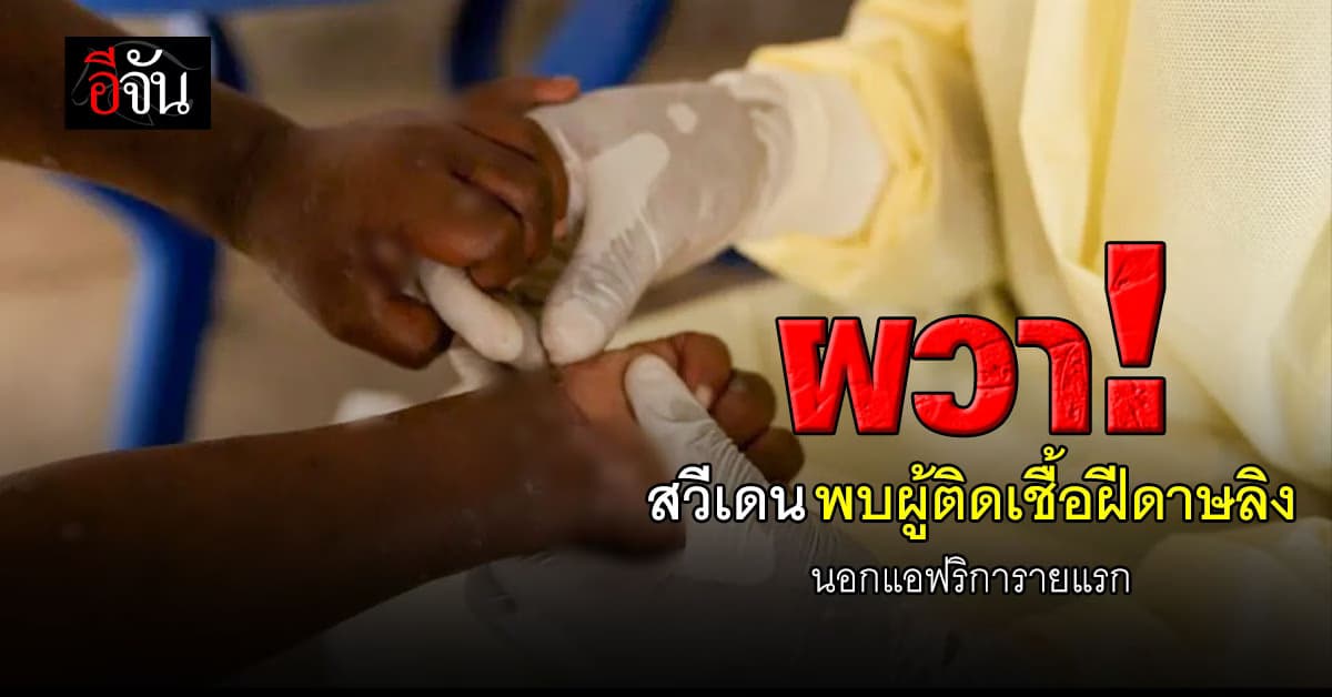 สวีเดน พบผู้ติดเชื้อฝีดาษลิงรายแรกนอกแอฟริกา เผยเป็นเชื้อชนิดอันตราย