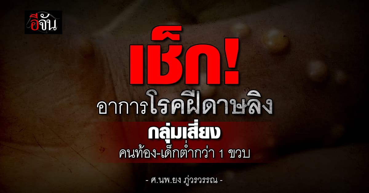 เช็ก! อาการโรคฝีดาษลิง กลุ่มเสี่ยงคนท้อง-เด็กต่ำกว่า 1 ขวบ