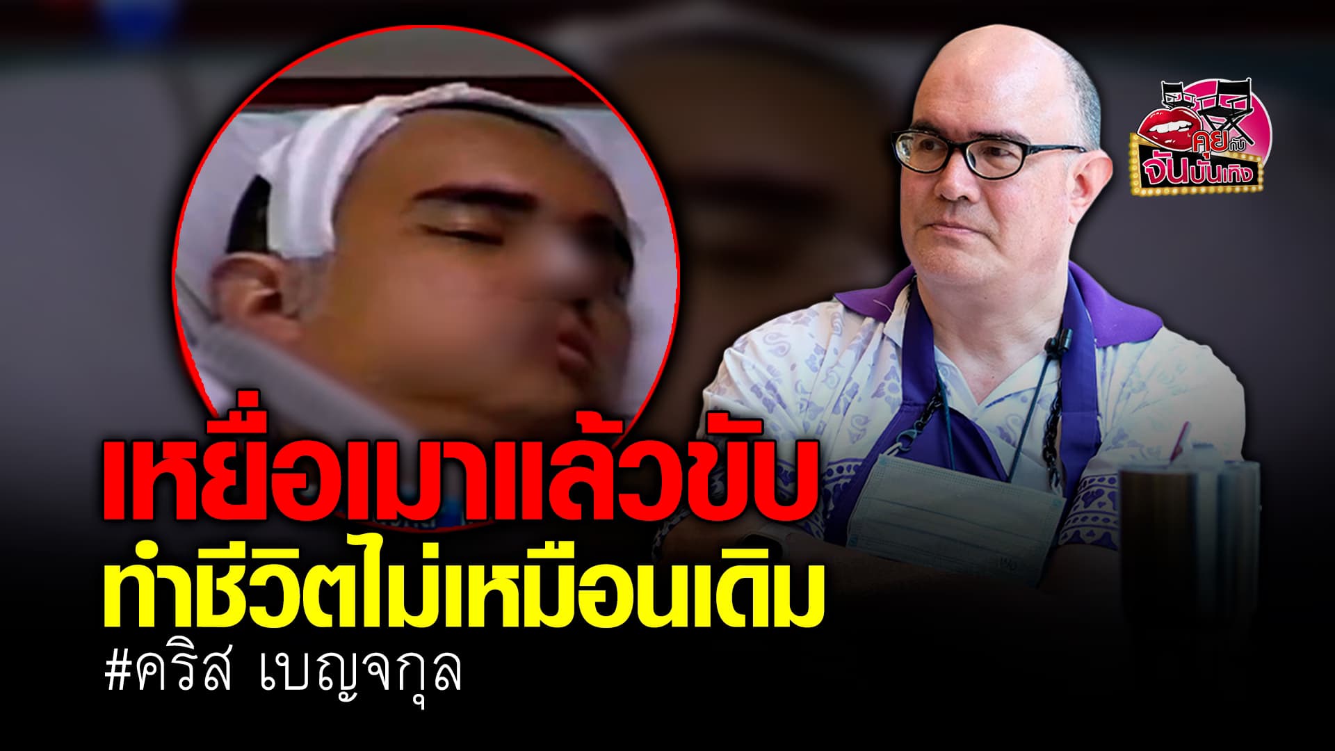 🎬คลิปบันเทิง : คริสโตเฟอร์ เบญจกุล จากนักแสดง สู่ชีวิตที่เปลี่ยนไป เพราะเป็นเหยื่อ เมาแล้วขับ