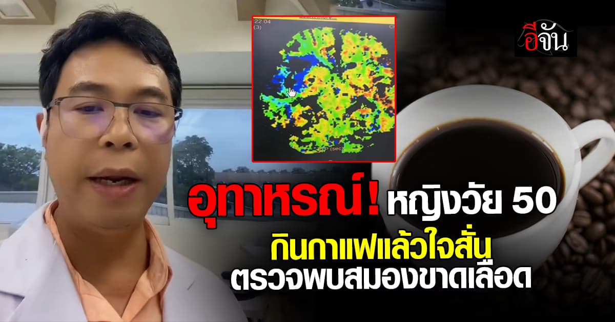 หมอประชา ยกเคสเตือน กินกาแฟแล้วใจสั่น ตรวจพบสมองขาดเลือด 