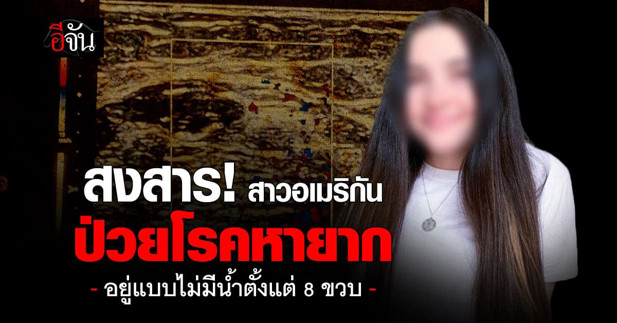 สงสารจับใจ! สาวอเมริกัน ป่วยโรคหายาก ต้องอยู่แบบไม่มีน้ำตั้งแต่ 8 ขวบ 