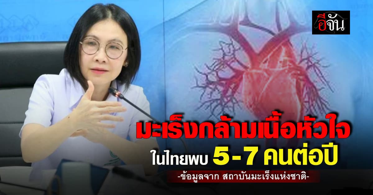 มะเร็งกล้ามเนื้อหัวใจ พราก อ๋อม อรรคพันธ์ หมอเผย ในไทยพบ 5-7 คนต่อปี 