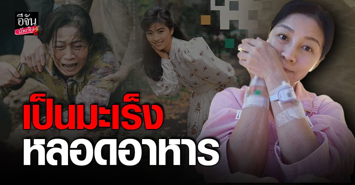 นางเอกชื่อดัง ฟาง เหวินหลิน ป่วยโรคมะเร็งหลอดอาหาร ระยะที่ 0