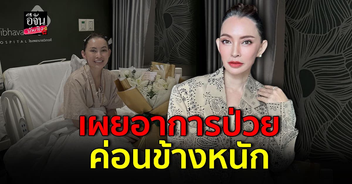 ปุ้ย พิมลวรรณ เล่าอาการป่วย เป็นไวรัสงูสวัด เจอยาแรง