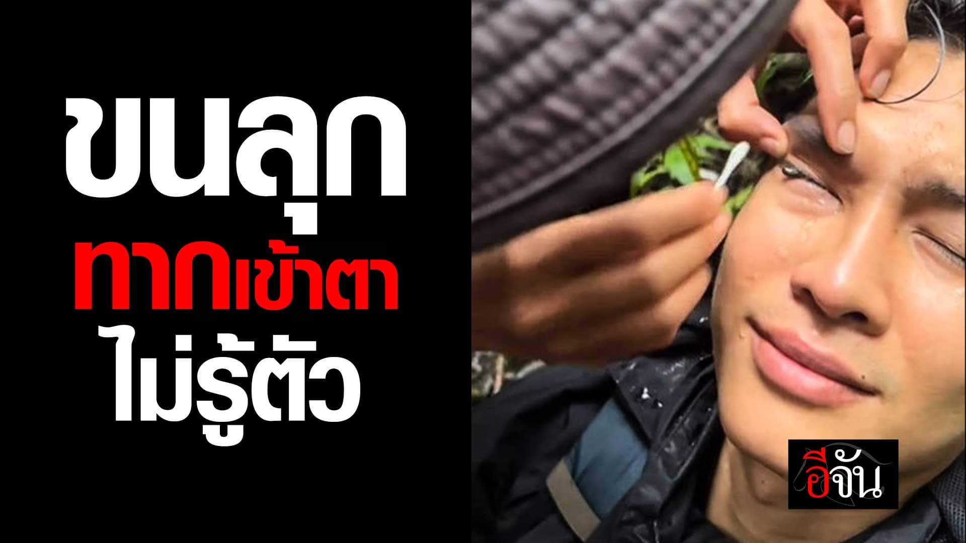 🎬 เรื่องสยองของนักเดินป่า ทากเข้าตา ไม่รู้ตัว