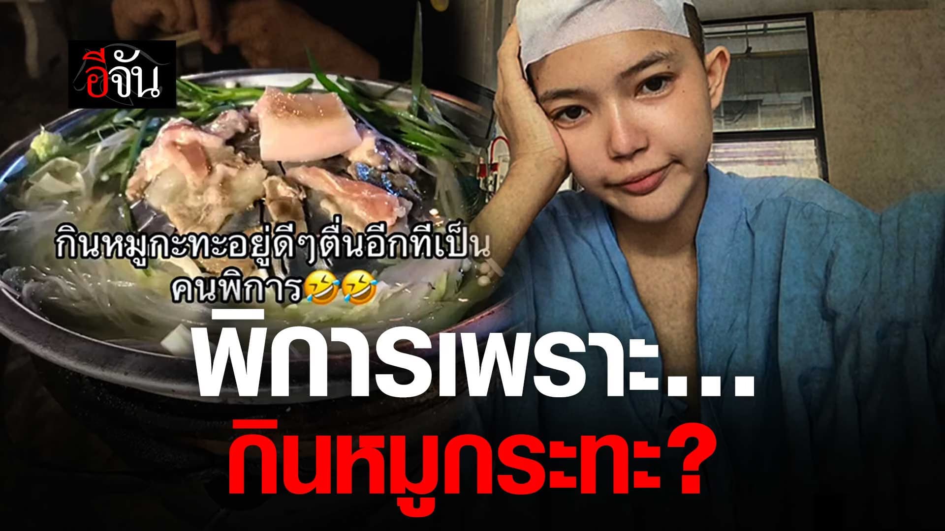 🎬 อุทาหรณ์ พิการเพราะ… กินหมูกระทะ?