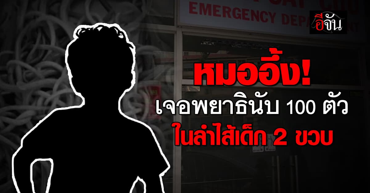 หมออึ้ง! พบพยาธิในลำไส้เด็ก 2 ขวบ กว่า 100 ตัว 