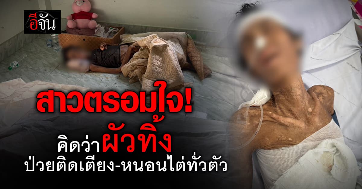 สุดหดหู่! สาวเข้าใจว่าผัวทิ้ง ตรอมใจหนัก ไม่กินข้าวจนป่วยติดเตียง หนอนไต่ยั้วเยี้ยทั่วตัว 