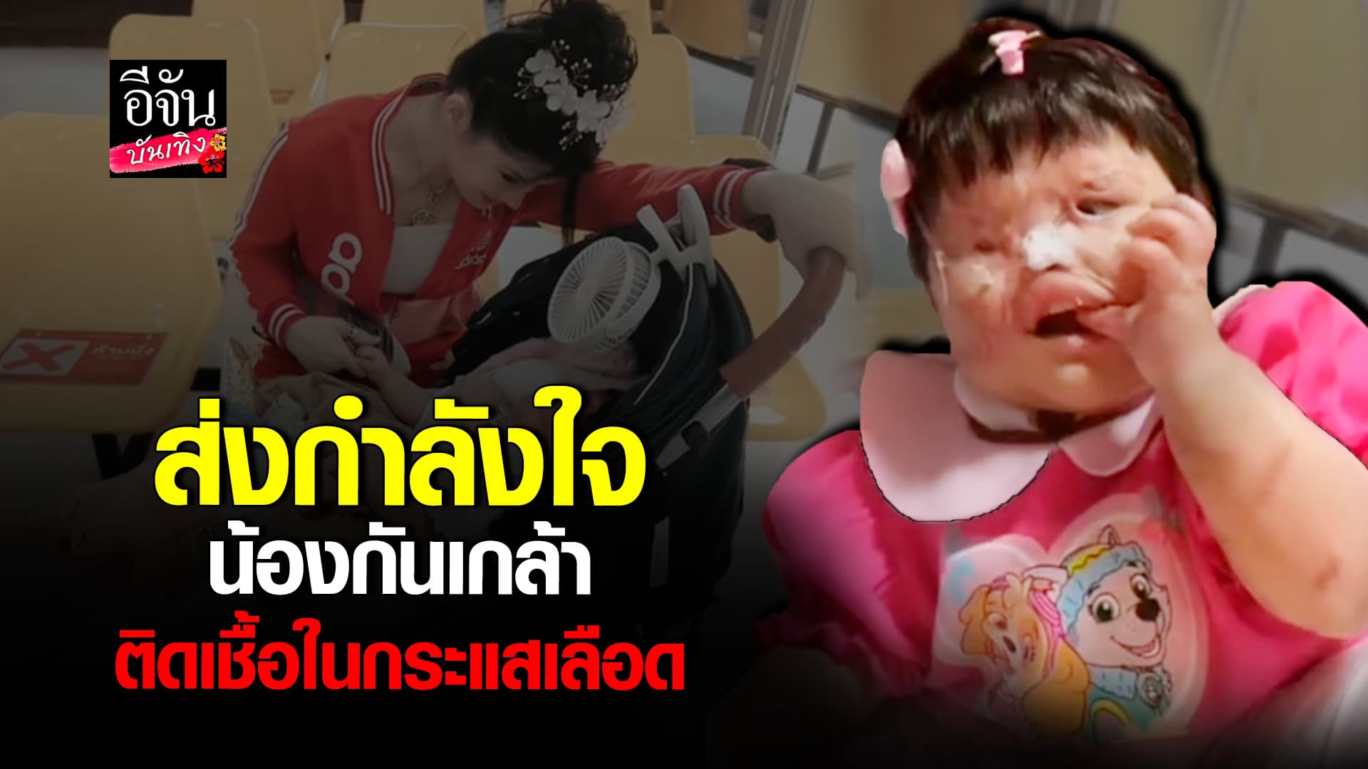 🎬คลิปบันเทิง : บีบหัวใจ หมอปลา – น้ำฟ้า สุดห่วงลูกสาว น้องกันเกล้า หลังเข้าผ่าตัดใหญ่ มีอาการติดเชื้อในกระแสเลือด