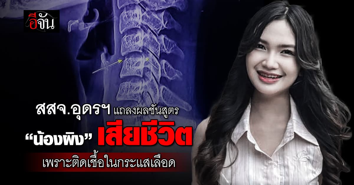 สสจ.อุดรธานี แถลงผลชันสูตร “ผิง ชญาดา” เสียชีวิต เพราะติดเชื้อในกระแสเลือด-มีเชื้อรา