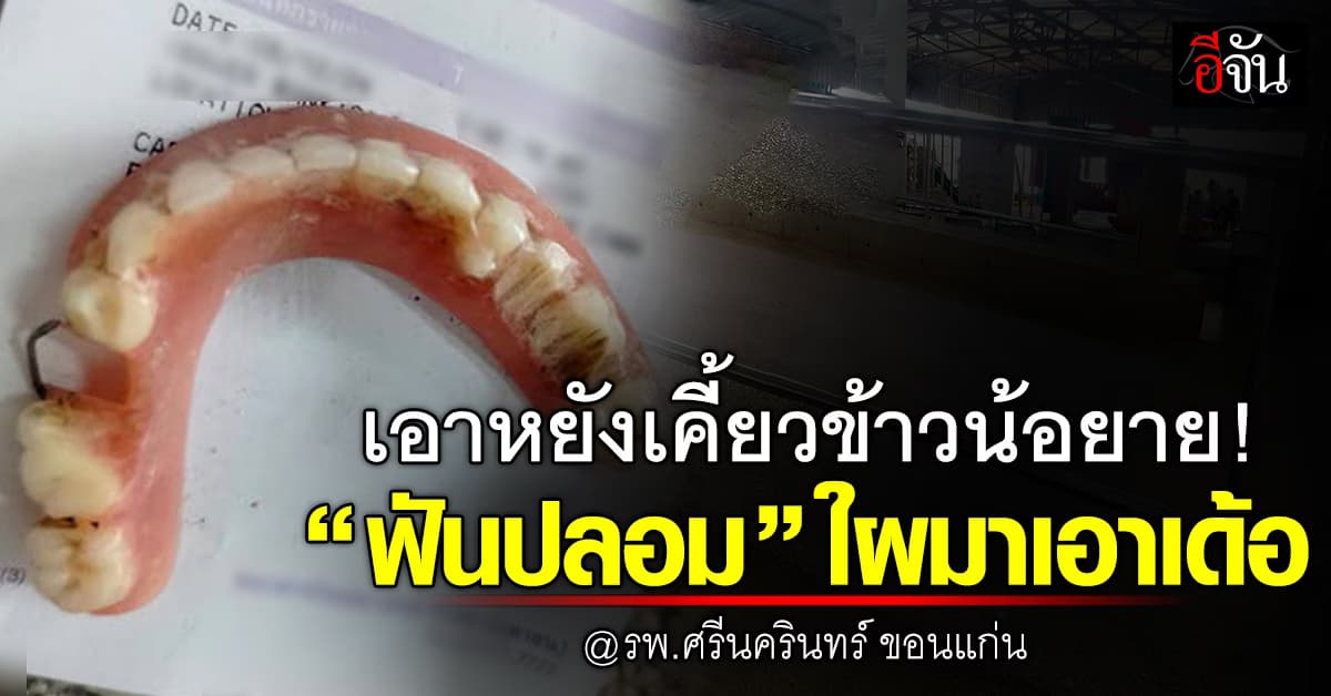 ประกาศ! ตามหาเจ้าของ ใครลืม “ฟันปลอม” มารับด่วน  