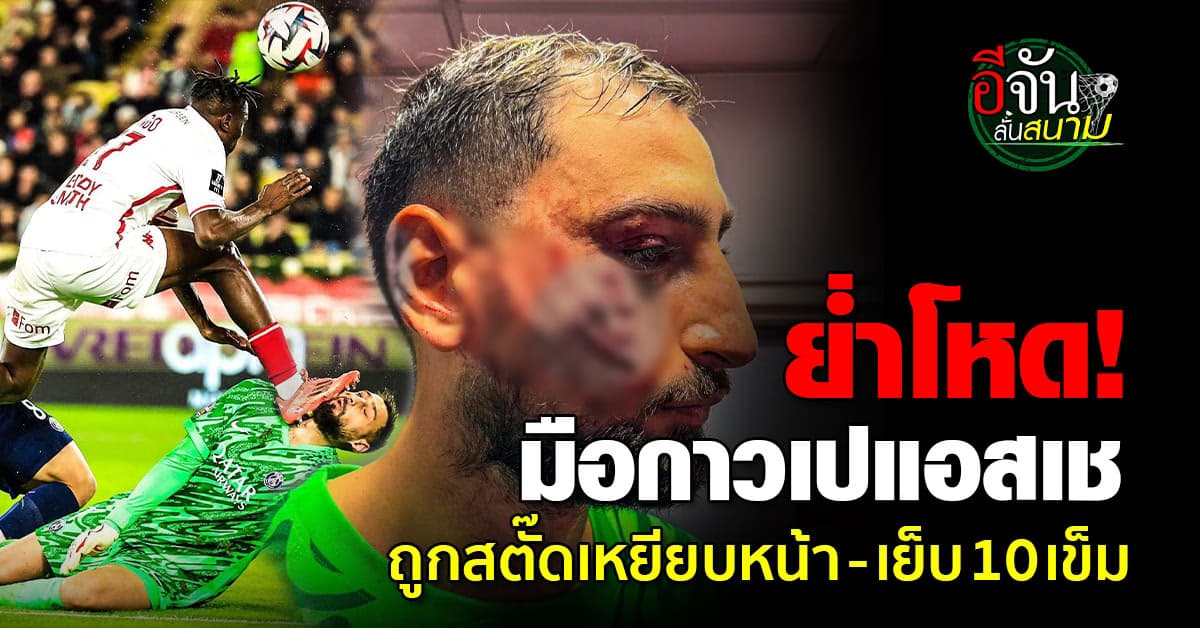 ย่ำโหด! นายทวารเปแอสแชถูกสตั๊ดคู่แข่งเหยียบหน้า – เย็บ 10 เข็ม