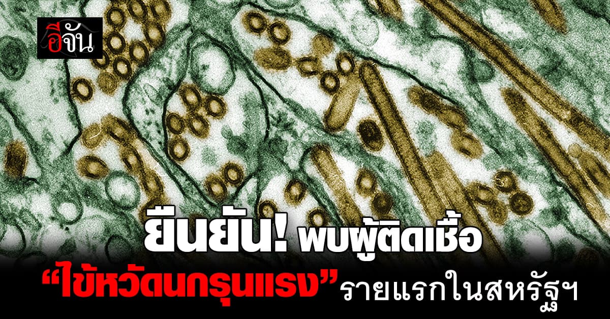 สหรัฐฯ เผย พบผู้ติดเชื้อ “ไข้หวัดนกอาการรุนแรง” รายแรกในประเทศ