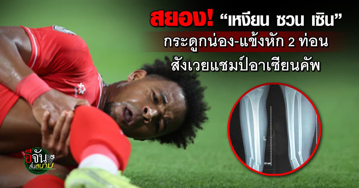 สยอง! “เหงียน ซวน เซิน” เดอะแบกเวียดนาม เจ็บหนัก กระดูกน่อง-แข้งหัก 2 ท่อน สังเวยแชมป์อาเซียน