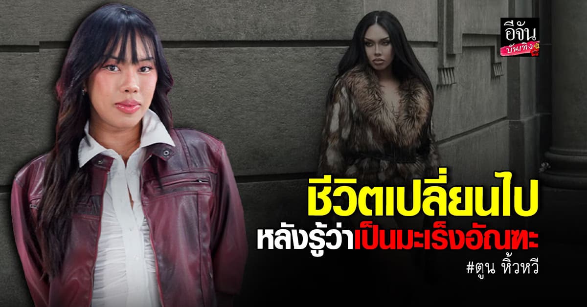 ตูน หิ้วหวี รับชีวิตเปลี่ยนไป หลังตรวจพบ เป็นมะเร็งอัณฑะ