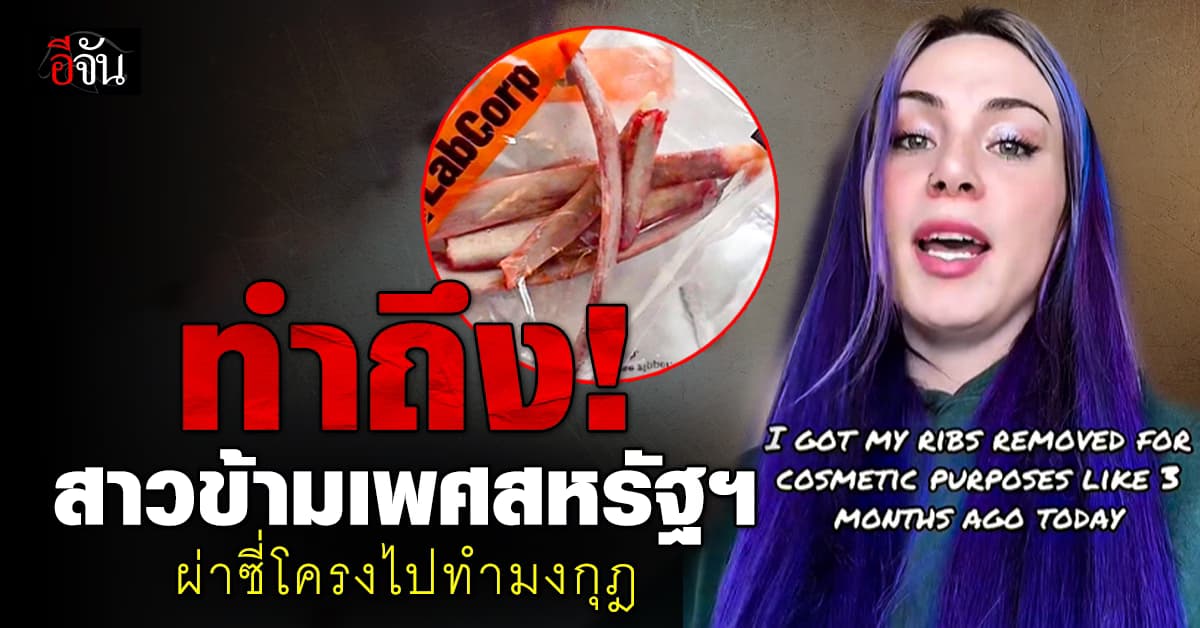 ทำถึง! สาวข้ามเพศสหรัฐฯ ผ่าตัดลดขนาดเอว – ก่อนนำกระดูกไปทำมงกุฎ