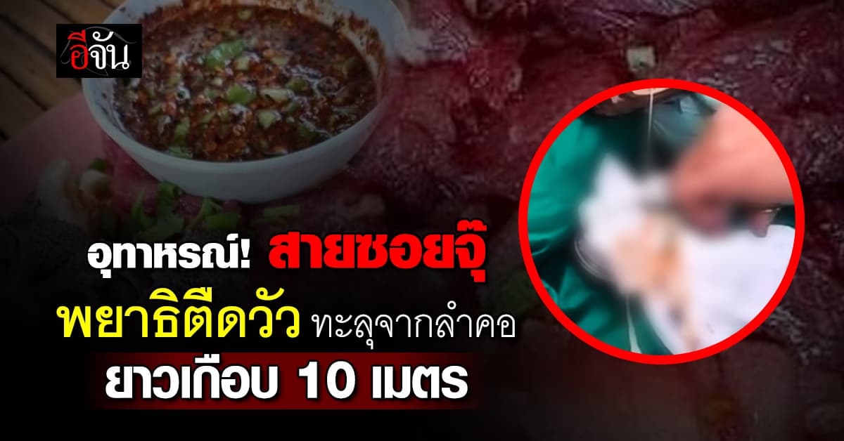 อุทาหรณ์! สายซอยจุ๊ “พยาธิตืดวัว” ยาวเกือบ 10 เมตร ทะลุออกจากลำคอ  