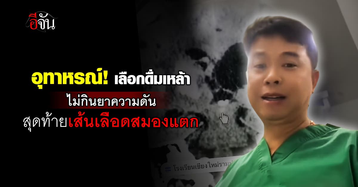 อุทาหรณ์! เลือกดื่มเหล้า ไม่กินยาความดัน สุดท้ายเส้นเลือดสมองแตก