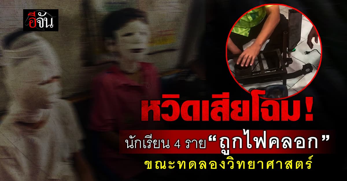 หวิดเสียโฉม! เกิดเหตุ “ไฟคลอก” นักเรียน 4 ราย ขณะทดลองวิทยาศาสตร์ ได้รับบาดเจ็บ