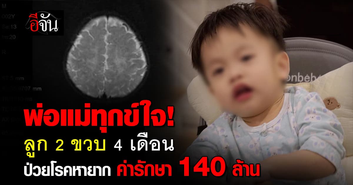 พ่อแม่ทุกข์ใจ! ลูก 2 ขวบ 4 เดือน ป่วยโรคหายาก ค่ารักษา 140 ล้าน
