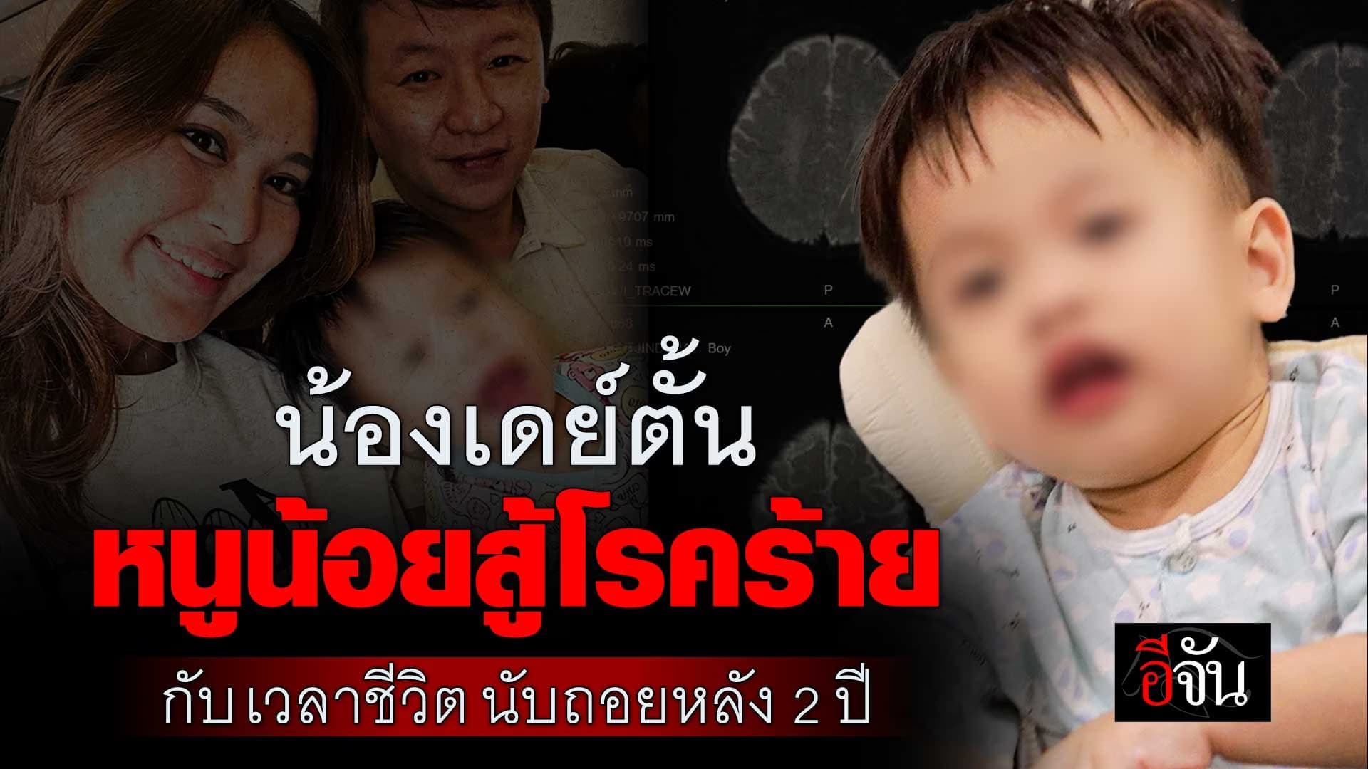 🎬 น้องเดย์ตั้น ป่วยโรคหายาก ค่ารักษา 140 ล้าน กับเวลาชีวิต นับถอยหลัง 2 ปี