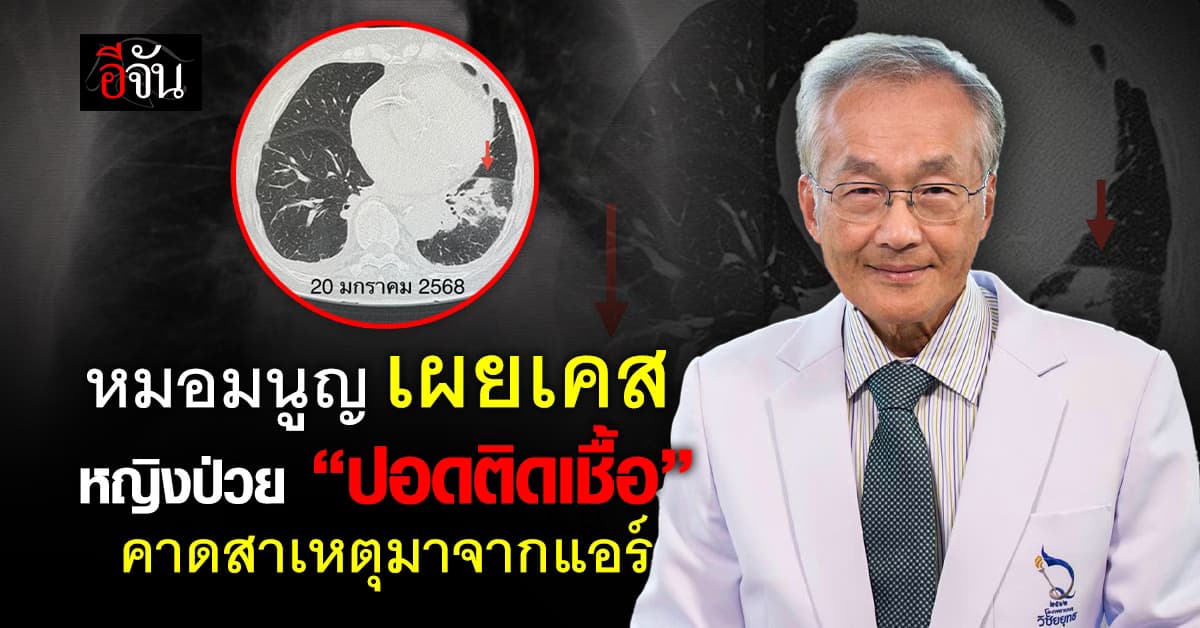 หมอมนูญ เผยเคสหญิงวัย 88 ป่วย “ปอดติดเชื้อ” คาดสาเหตุมาจากแอร์