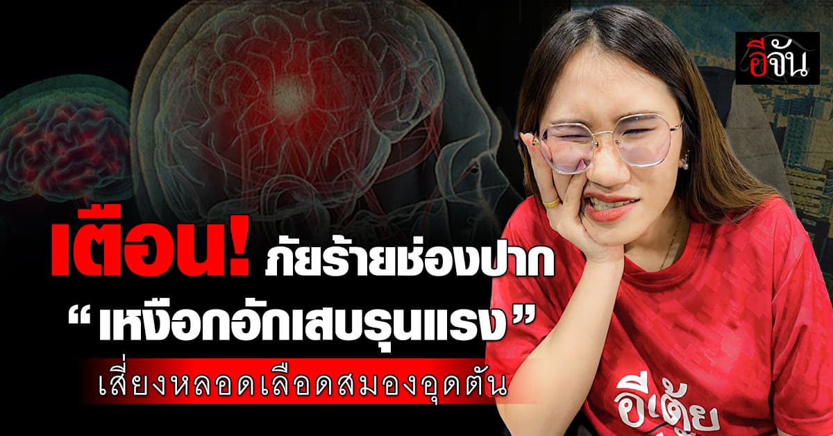 หมอหมู เตือน “เหงือกอักเสบรุนแรง” อาจเสี่ยงหลอดเลือดสมองอุดตัน