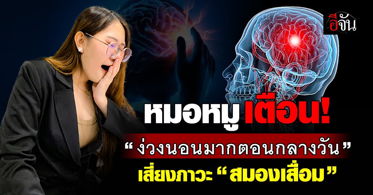 เช็กกันด้วย! หมอหมู เตือน “ง่วงนอนตอนกลางวันมากผิดปกติ” เสี่ยงภาวะสมองเสื่อม