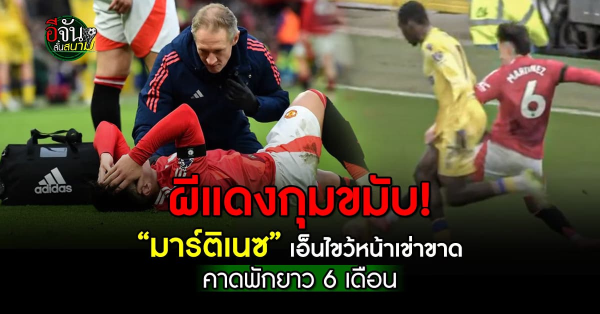 ดวงแตก! “มาร์ติเนซ” เอ็นไขว้หน้าเข่าขาด พักยาว 6-8 เดือน ปิดฉากฤดูกาลนี้แล้ว