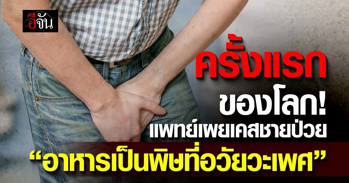 แปลกแต่จริง! แพทย์เผยเคสชายป่วย “อาหารเป็นพิษที่อวัยวะเพศ” ครั้งแรกของโลก