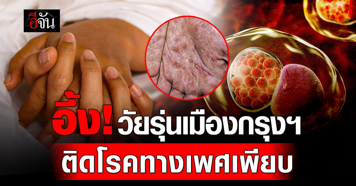 อึ้ง! สำนักอนามัย ชี้ “วัยรุ่นเมืองกรุงฯ” ติดโรคทางเพศเพียบ