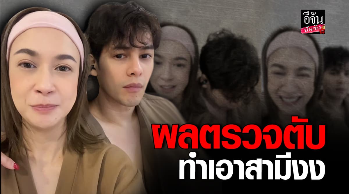 เอมี่ กลิ่นประทุม เผยผลตรวจตับ ทำเอา ซี ศิวัฒน์ งง “หมอโกหกหรือเปล่า”