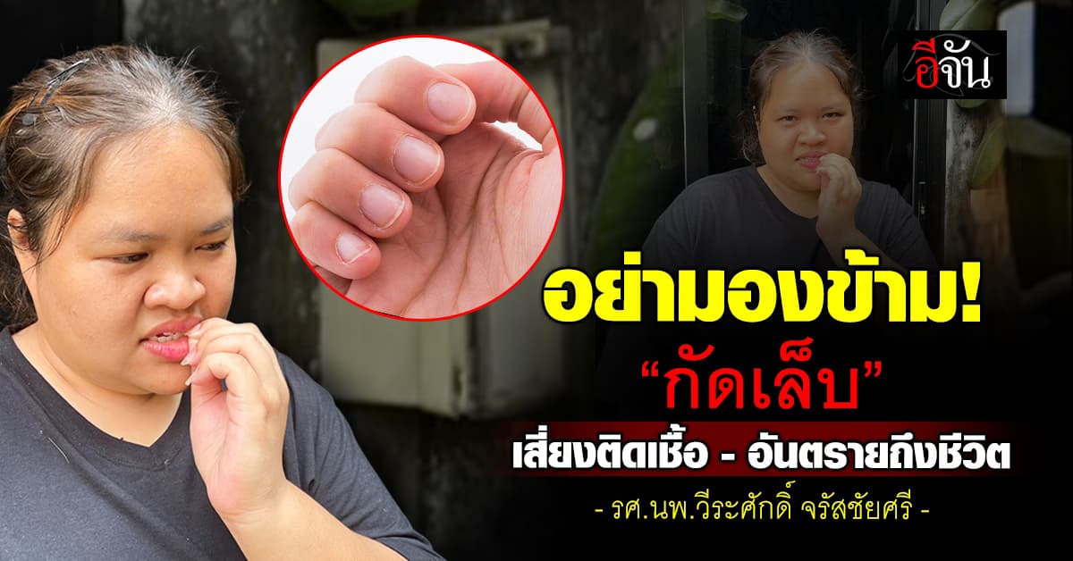 อย่ามองข้าม! หมอหมู เตือน “กัดเล็บ” เสี่ยงติดเชื้อรุนแรง อันตรายถึงชีวิต แนะเลิกได้เลิก