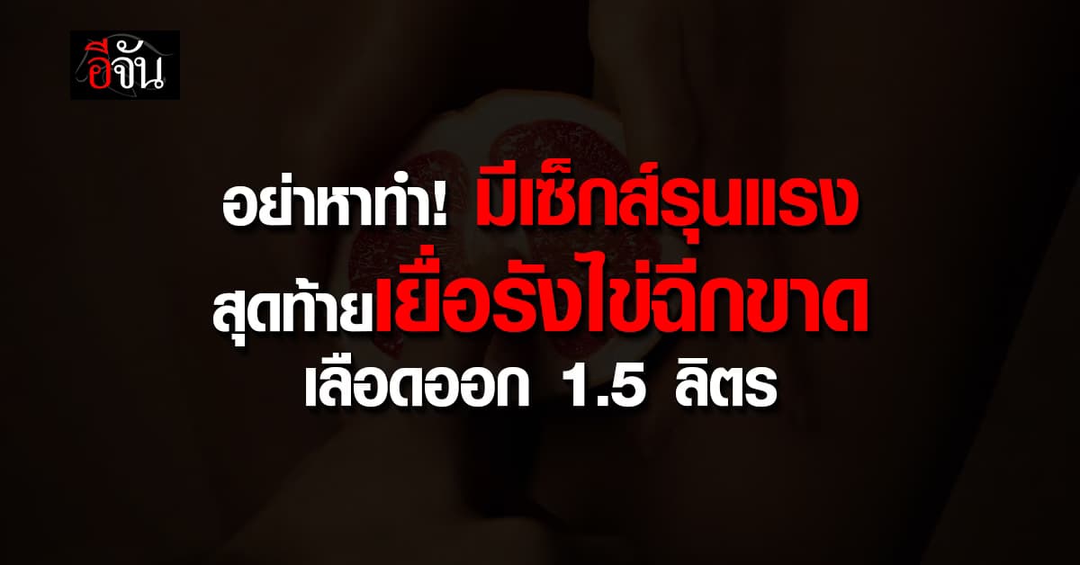 อย่าหาทำ! สาววัย 28 ปี มีเซ็กส์รุนแรง สุดท้ายเยื่อรังไข่ฉีกขาด เลือดออก 1.5 ลิตร