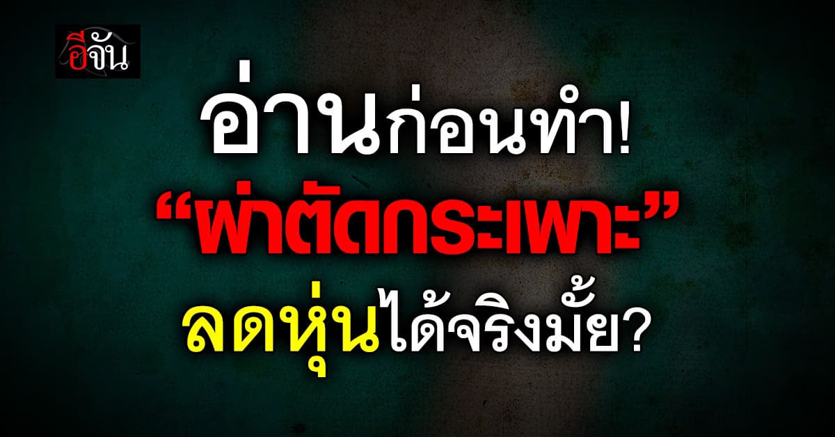 ใครจะทำ อ่านก่อน! “ผ่าตัดกระเพาะอาหาร” ลดน้ำหนักได้จริงมั้ย? 