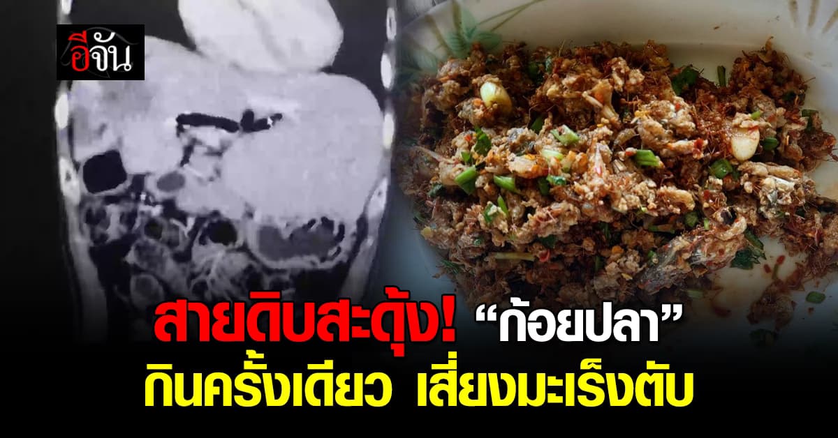 สายดิบสะดุ้ง! “ก้อยปลา” แม้ทานแค่ครั้งเดียว เสี่ยงมะเร็งตับ
