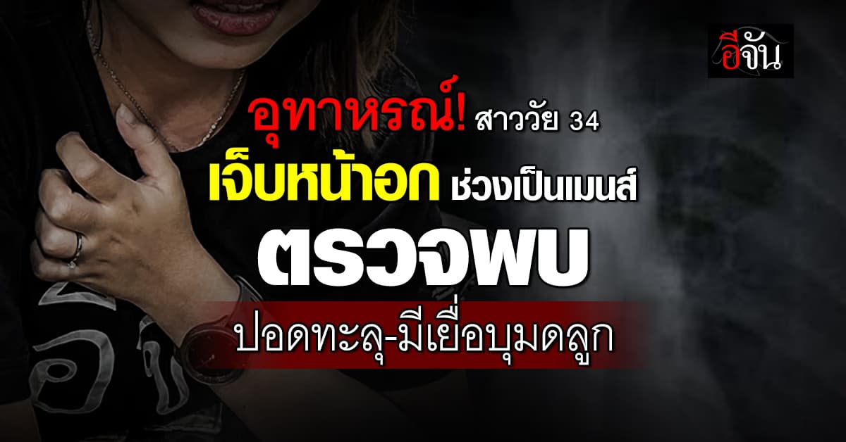 อุทาหรณ์! สาววัย 34 ปี เจ็บหน้าอกช่วงเป็นเมนส์ ตรวจพบปอดทะลุ-มีเยื่อ