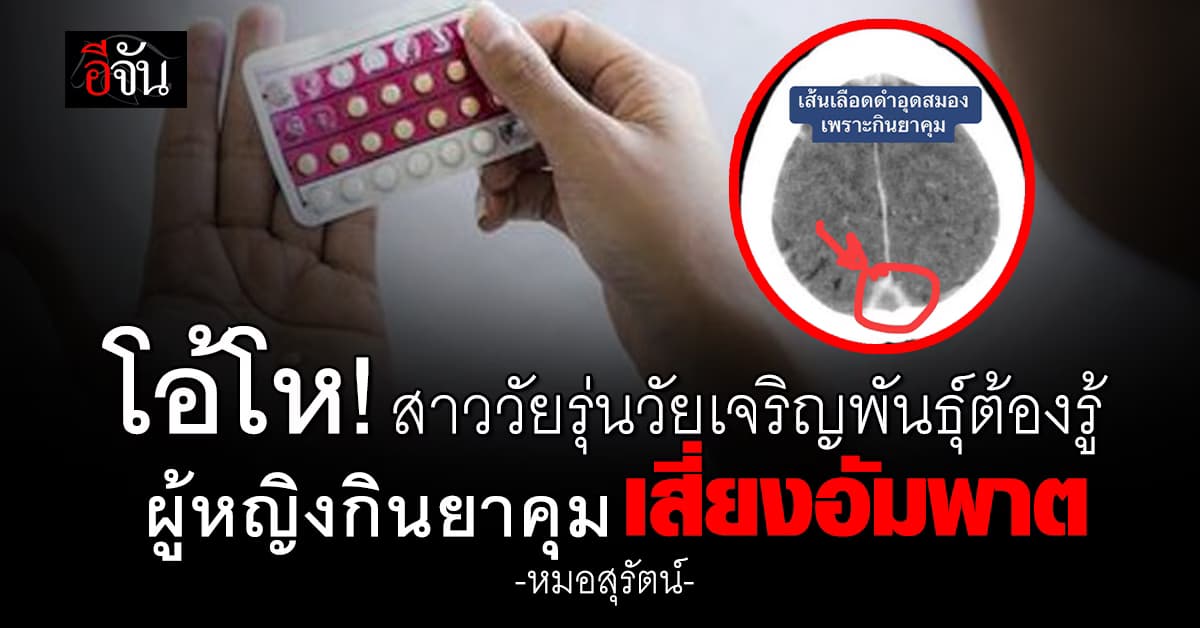 หมอสุรัตน์ เตือน ผู้หญิงกินยาคุม เสี่ยงอัมพาต