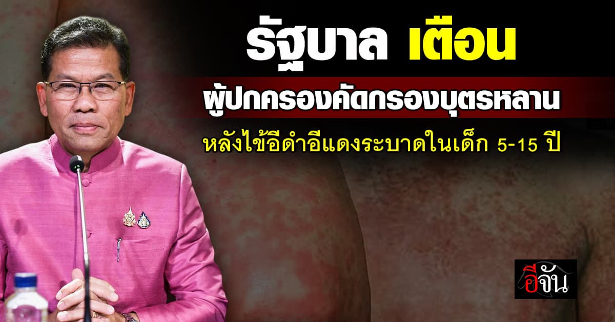 รัฐบาล เตือนผู้ปกครองคัดกรองบุตรหลาน หลังพบไข้อีดำอีแดงระบาดในเด็ก 5-15 ปี