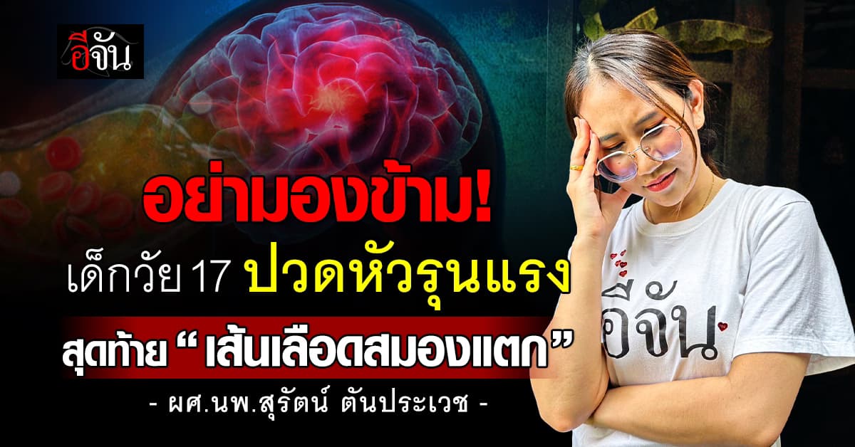 อย่ามองข้าม! “หมอสุรัตน์” ยกเคสเด็ก 17 ปวดหัวหนัก ก่อนพบเส้นเลือดสมองแตก
